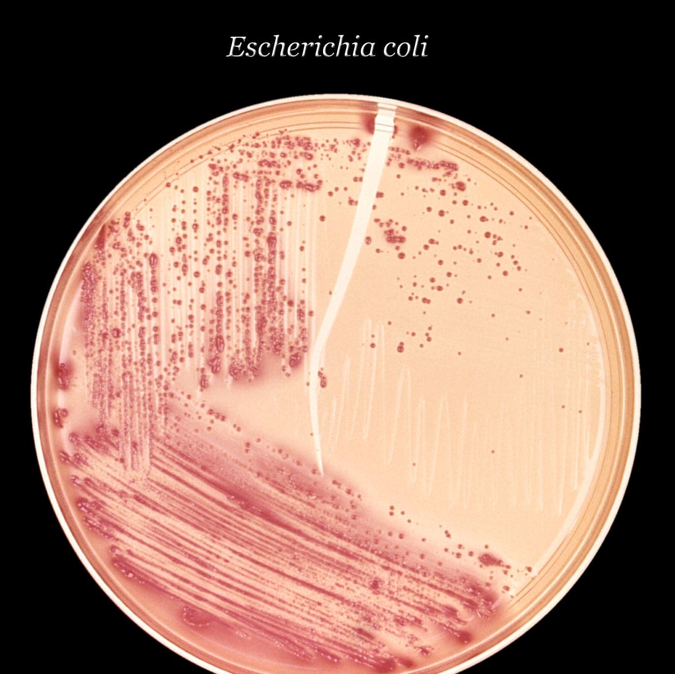 Escherichia coli (E. coli) ו-STEC: סיכונים וזיהוי במזון