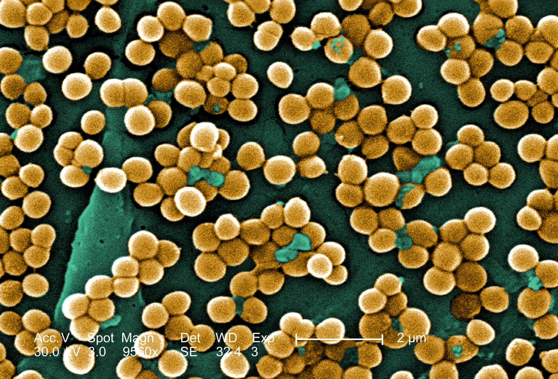 Staphylococcus aureus: הפתוגן שפועל דרך הרעלן שלו, לא דרך החיידק החי