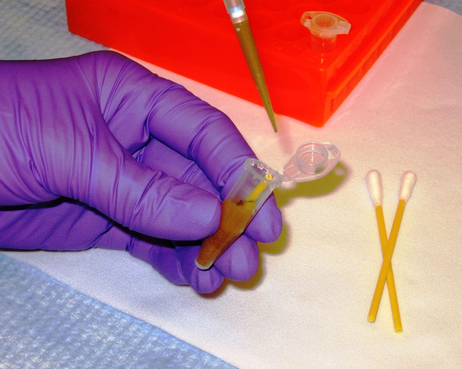 מיצוי חומצות גרעין: השלב הבלתי נראה שלפני כל PCR