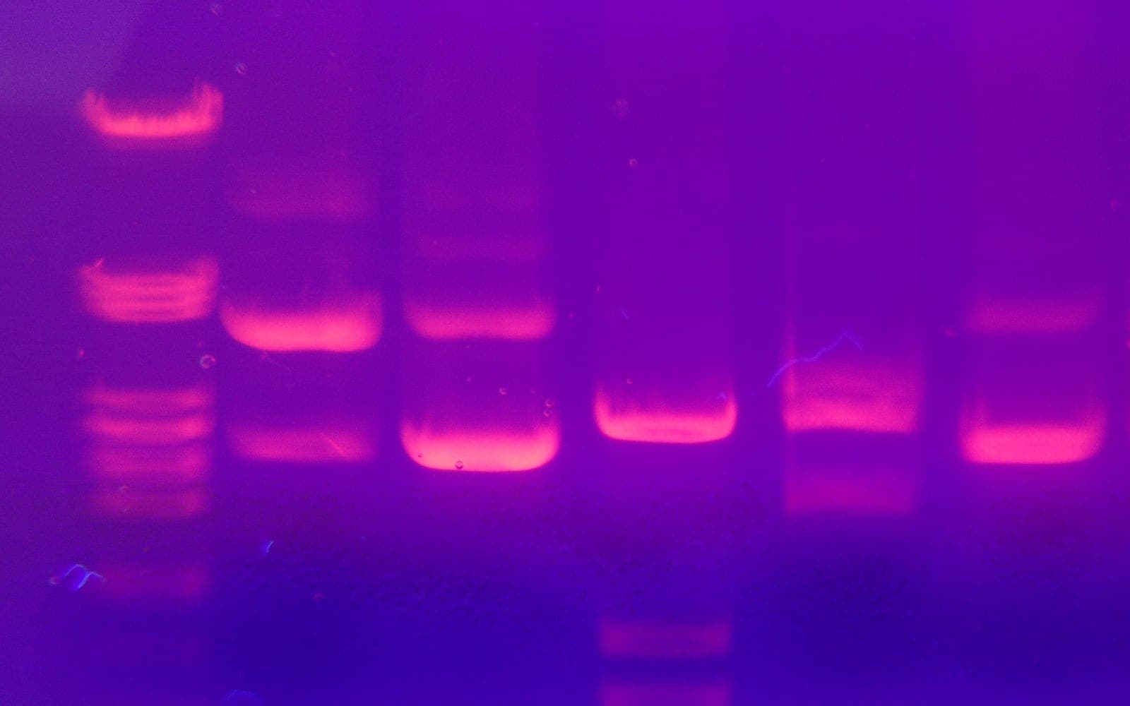 RNA מול DNA: איזו מולקולה כדאי להגביר כדי לזהות מיקרואורגניזם חי