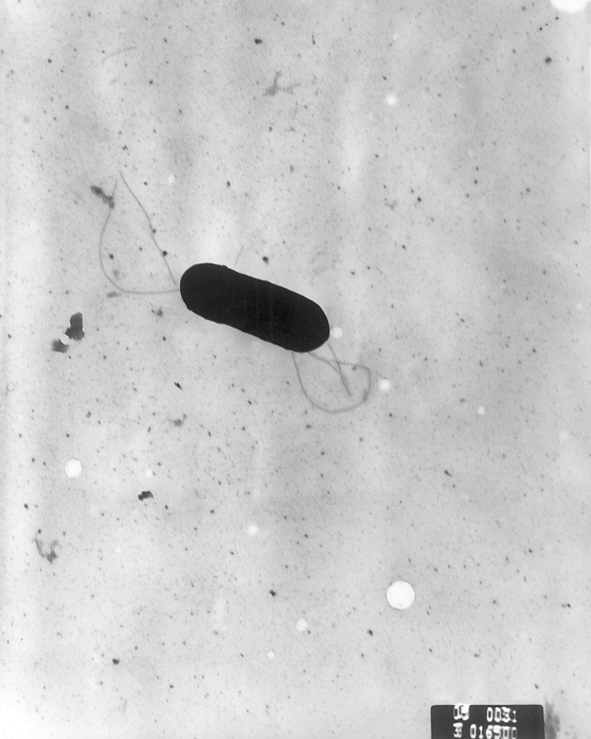 Listeria monocytogenes: סיכונים ושיטות זיהוי
