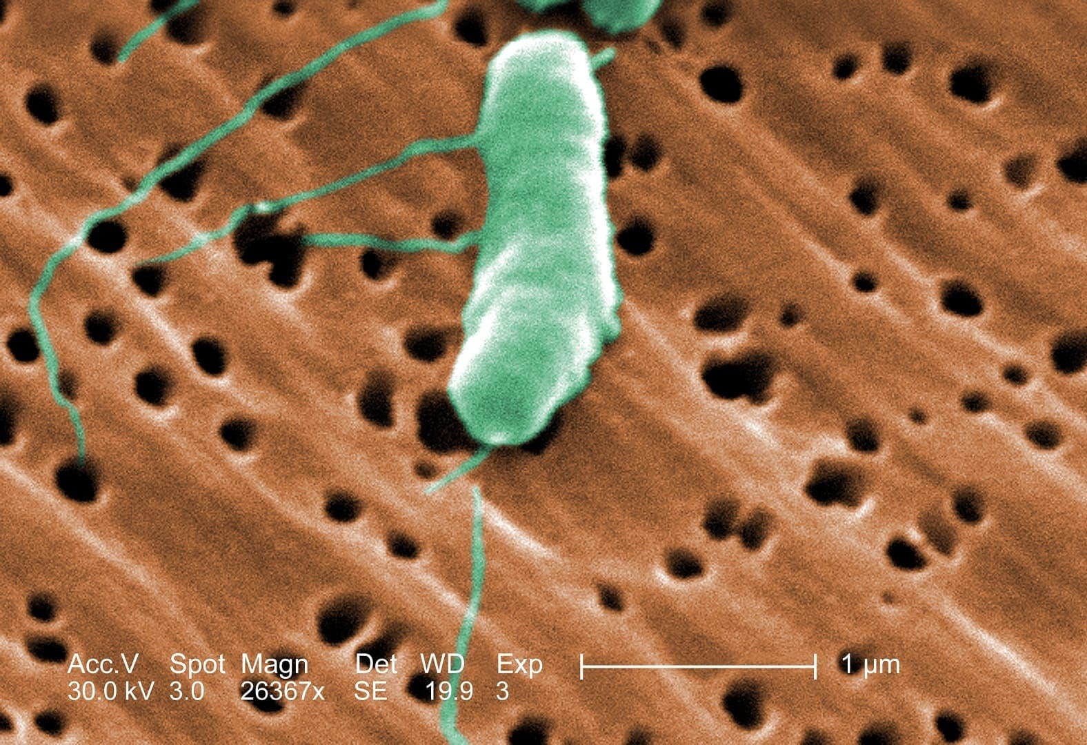 Aumentan los Casos de Vibrio vulnificus en la Costa del Golfo de EE. UU. este Verano