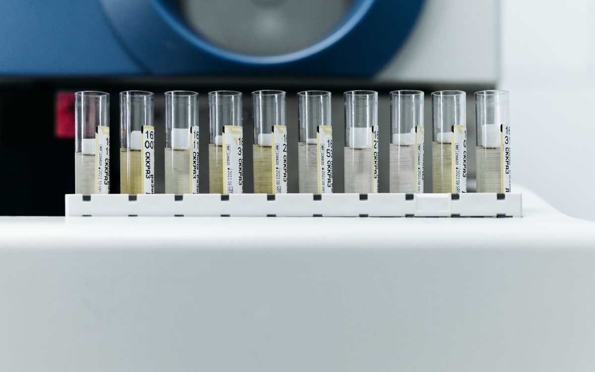 Das CFS von Hongkong Meldet Sieben Unzufriedenstellende Proben unter 3.600 Analysen im März