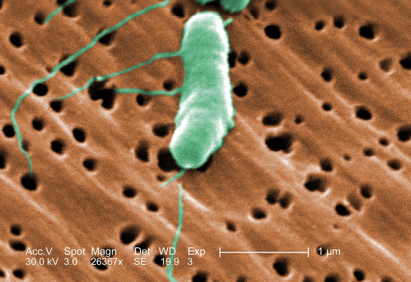 Aumentan los Casos de Vibrio vulnificus en la Costa del Golfo de EE. UU. este Verano
